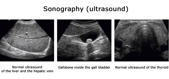 Ultrasound examination