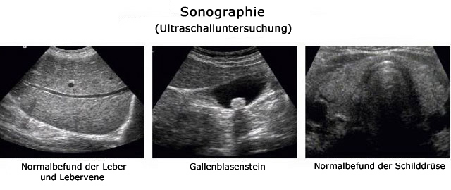 Sonographie - Ultraschalluntersuchungen